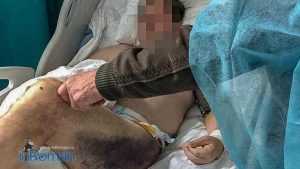 leziuni pacient 1 front