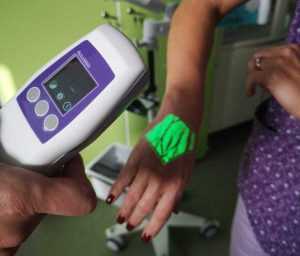 aparat de iluminat vene