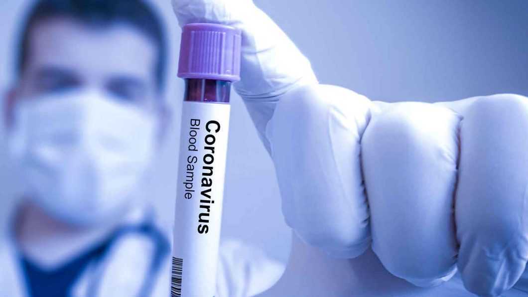 coronavirus eprubeta medic